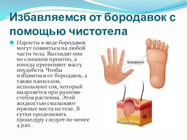 Избавляемся от бородавок с помощью чистотела Наросты в виде бородавок могут появиться