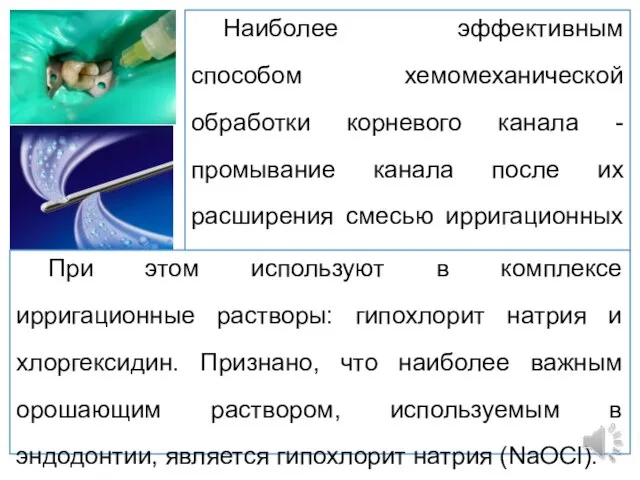 Наиболее эффективным способом хемомеханической обработки корневого канала - промывание канала после их