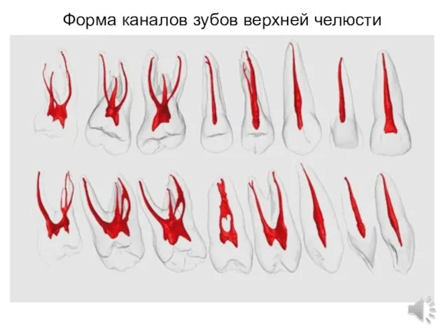 Форма каналов зубов верхней челюсти