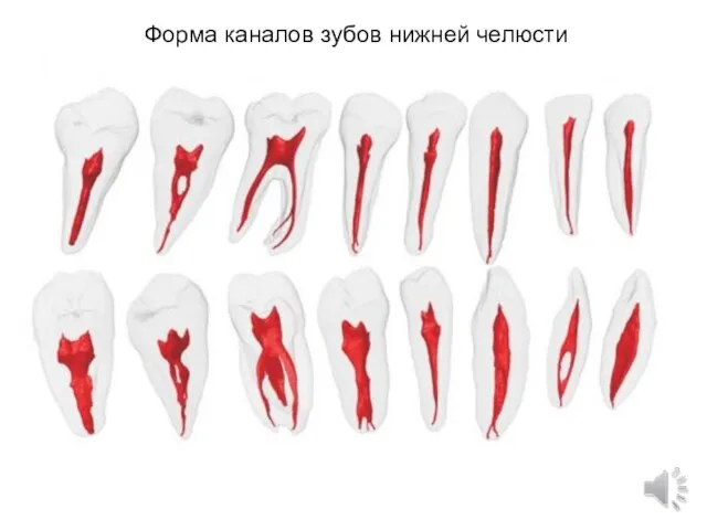 Форма каналов зубов нижней челюсти