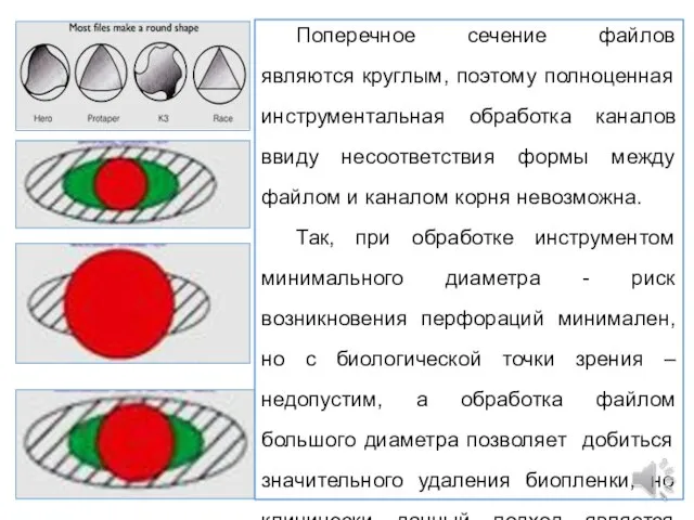 Поперечное сечение файлов являются круглым, поэтому полноценная инструментальная обработка каналов ввиду несоответствия