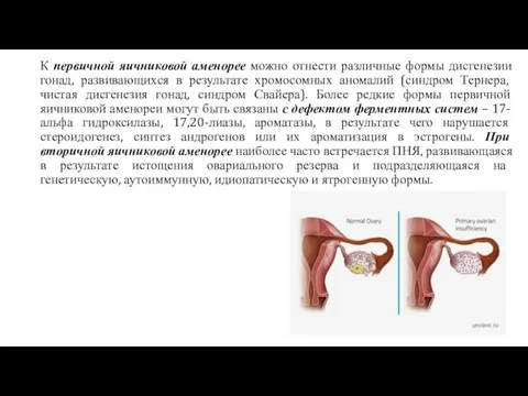 К первичной яичниковой аменорее можно отнести различные формы дисгенезии гонад, развивающихся в