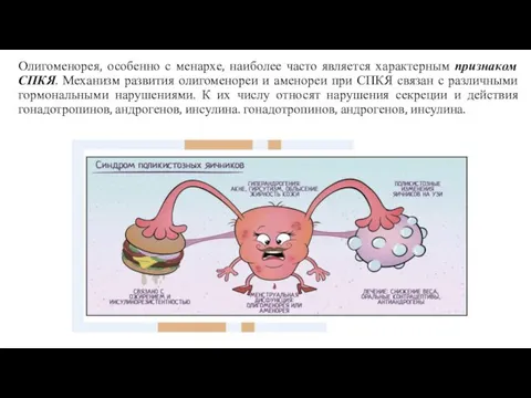 Олигоменорея, особенно с менархе, наиболее часто является характерным признаком СПКЯ. Механизм развития