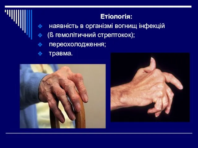 Етіологія: наявність в організмі вогнищ інфекцій (ß гемолітичний стрептокок); переохолодження; травма.