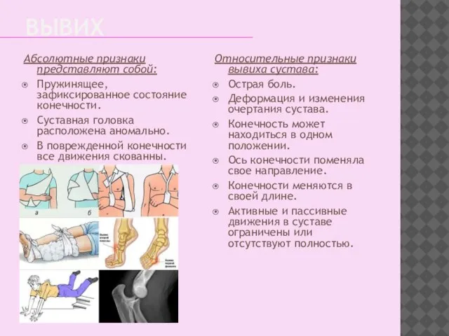 ВЫВИХ Абсолютные признаки представляют собой: Пружинящее, зафиксированное состояние конечности. Суставная головка расположена