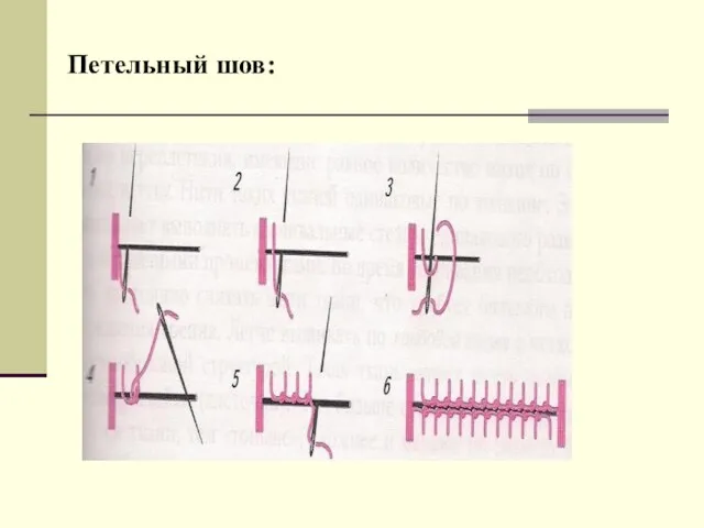 Петельный шов: