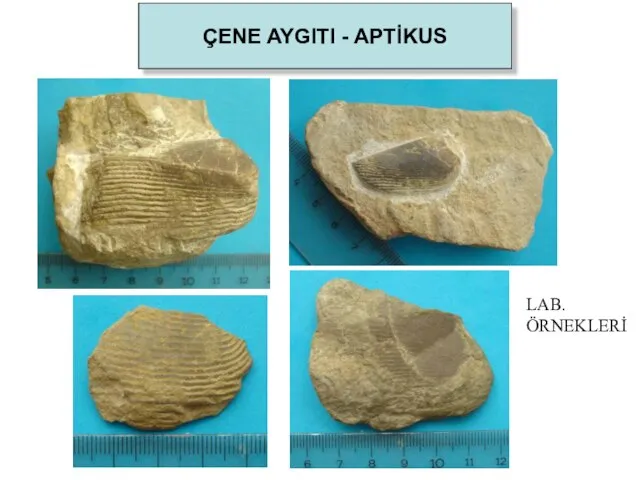 ÇENE AYGITI - APTİKUS LAB. ÖRNEKLERİ