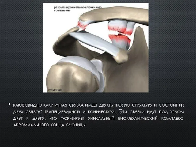 клювовидно-ключичная связка имеет двухпучковую структуру и состоит из двух связок: трапециевидной и