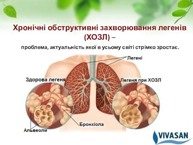 Хронічні обструктивні захворювання легенів (ХОЗЛ) – проблема, актуальність якої в усьому світі стрімко зростає.