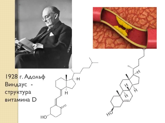 1928 г. Адольф Виндаус - структура витамина D