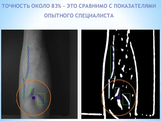 ТОЧНОСТЬ ОКОЛО 83% - ЭТО СРАВНИМО С ПОКАЗАТЕЛЯМИ ОПЫТНОГО СПЕЦИАЛИСТА