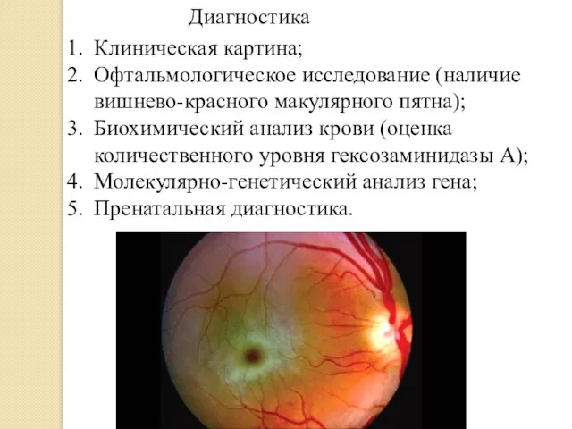 Диагностика Клиническая картина; Офтальмологическое исследование (наличие вишнево-красного макулярного пятна); Биохимический анализ крови