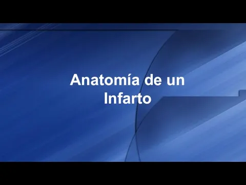 Anatomía de un Infarto