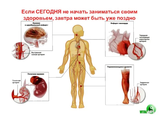 Если СЕГОДНЯ не начать заниматься своим здоровьем, завтра может быть уже поздно