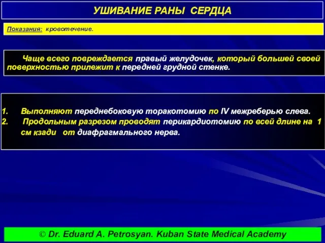 УШИВАНИЕ РАНЫ СЕРДЦА Чаще всего повреждается правый желудочек, который большей своей поверхностью