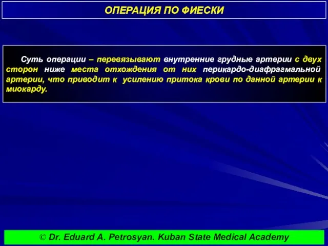 ОПЕРАЦИЯ ПО ФИЕСКИ Суть операции – перевязывают внутренние грудные артерии с двух