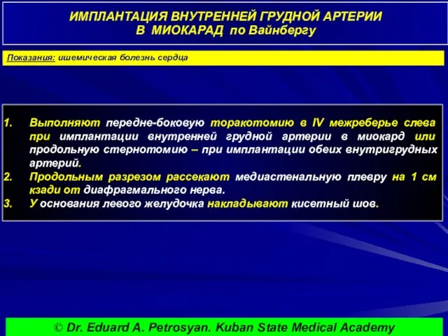 ИМПЛАНТАЦИЯ ВНУТРЕННЕЙ ГРУДНОЙ АРТЕРИИ В МИОКАРАД по Вайнбергу Показания: ишемическая болезнь сердца