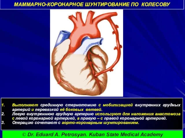 МАММАРНО-КОРОНАРНОЕ ШУНТИРОВАНИЕ ПО КОЛЕСОВУ Выполняют срединную стернотомию с мобилизацией внутренних грудных артерий