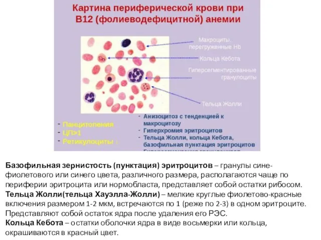 Базофильная зернистость (пунктация) эритроцитов – гранулы сине-фиолетового или синего цвета, различного размера,