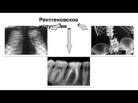 Рентгеновское излучение