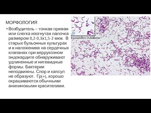 МОРФОЛОГИЯ Возбудитель – тонкая прямая или слегка изогнутая палочка размером 0,2-0,3х1,5-2 мкм.