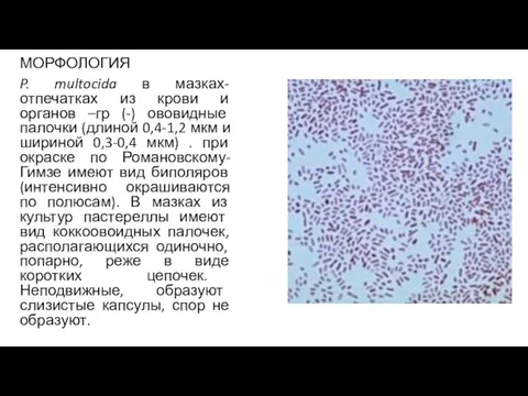 МОРФОЛОГИЯ P. multocida в мазках-отпечатках из крови и органов –гр (-) ововидные