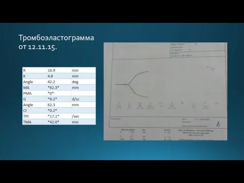 Тромбоэластограмма от 12.11.15.