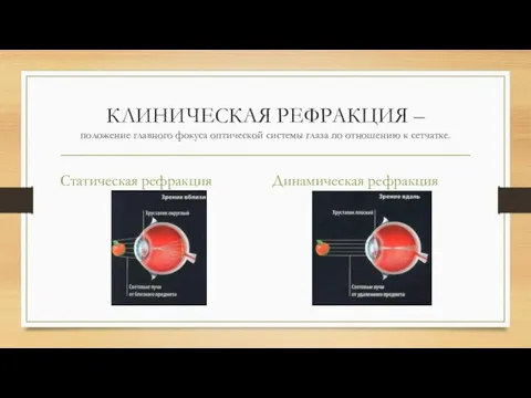 КЛИНИЧЕСКАЯ РЕФРАКЦИЯ – положение главного фокуса оптической системы глаза по отношению к