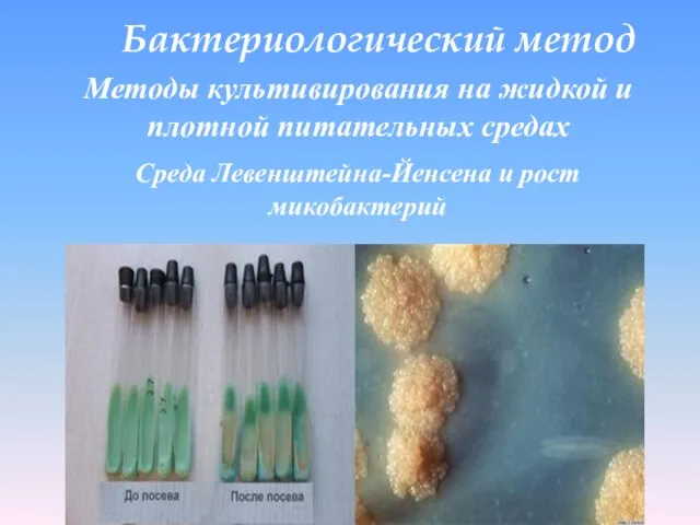 Бактериологический метод Методы культивирования на жидкой и плотной питательных средах Среда Левенштейна-Йенсена и рост микобактерий