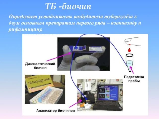 ТБ -биочип Определяет устойчивость возбудителя туберкулёза к двум основным препаратам первого ряда – изониазиду и рифампицину.