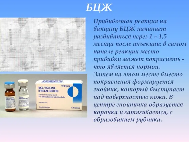 БЦЖ Прививочная реакция на вакцину БЦЖ начинает развиваться через 1 – 1,5