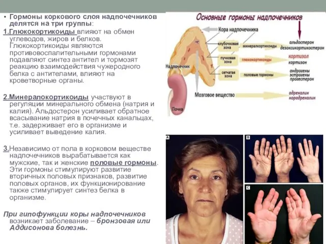 Гормоны коркового слоя надпочечников делятся на три группы: 1.Глюкокортикоиды влияют на обмен