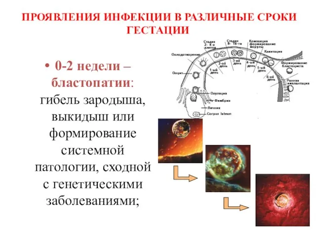 ПРОЯВЛЕНИЯ ИНФЕКЦИИ В РАЗЛИЧНЫЕ СРОКИ ГЕСТАЦИИ 0-2 недели – бластопатии: гибель зародыша,