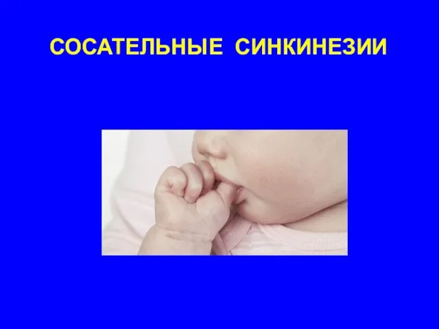 СОСАТЕЛЬНЫЕ СИНКИНЕЗИИ