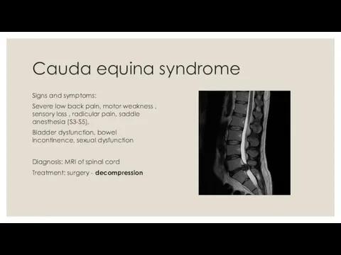 Cauda equina syndrome Signs and symptoms: Severe low back pain, motor weakness