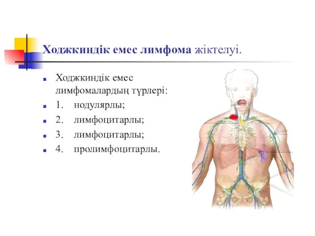 Ходжкиндік емес лимфома жіктелуі. Ходжкиндік емес лимфомалардың түрлері: 1. нодулярлы; 2. лимфоцитарлы; 3. лимфоцитарлы; 4. пролимфоцитарлы.