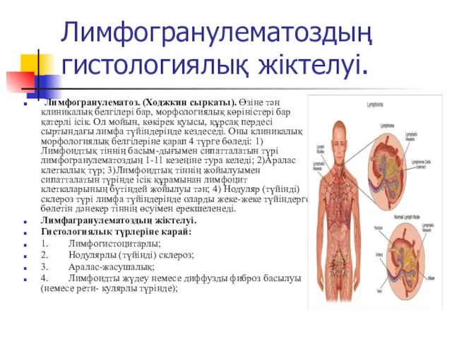 Лимфогранулематоздың гистологиялық жіктелуі. Лимфогранулематоз. (Ходжкин сырқаты). Өзіне тән клиникалық белгілері бар, морфологиялық