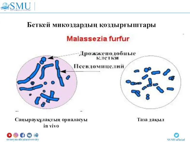 Беткей микоздардың қоздырғыштары Таза дақыл Саңырауқұлақтың орналасуы in vivo