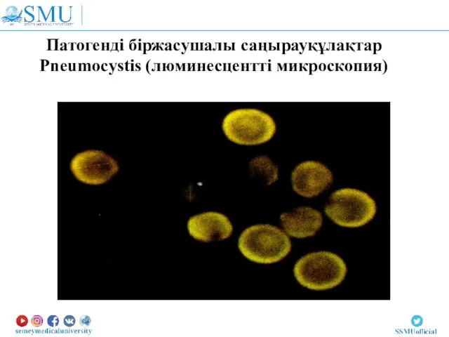 Патогенді біржасушалы саңырауқұлақтар Pneumocystis (люминесцентті микроскопия)