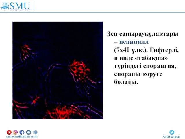 Зең саңырауқұлақтары – пеницилл (7х40 үлк.). Гифтерді, в виде «табақша» түріндегі спорангия, спораны көруге болады.