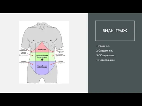 ВИДЫ ГРЫЖ 1-Малая п.г. 2-Средняя п.г. 3-Обширная п.г. 4-Гигантская п.г.