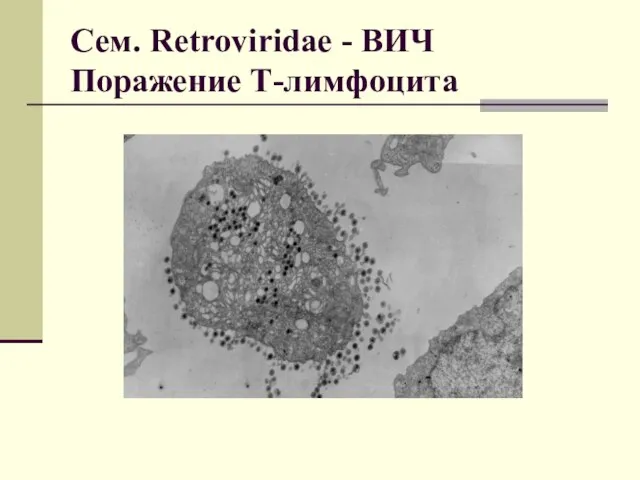 Сем. Retroviridae - ВИЧ Поражение Т-лимфоцита