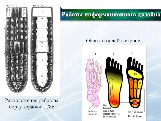 Работы информационного дизайна Расположение рабов на борту корабля, 1786 Области болей в ступне