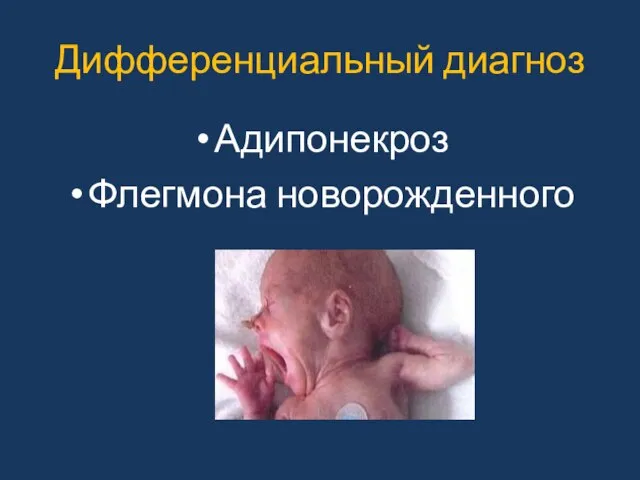 Дифференциальный диагноз Адипонекроз Флегмона новорожденного
