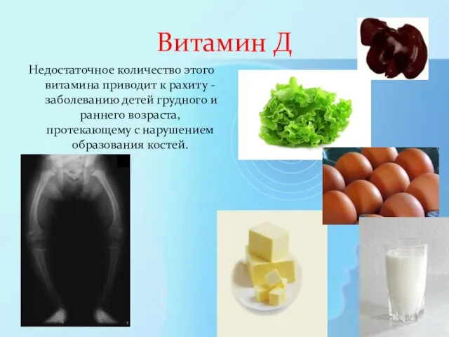 Витамин Д Недостаточное количество этого витамина приводит к рахиту - заболеванию детей