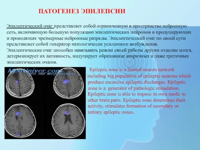 ПАТОГЕНЕЗ ЭПИЛЕПСИИ Эпилептический очаг представляет собой ограниченную в пространстве нейронную сеть, включающую