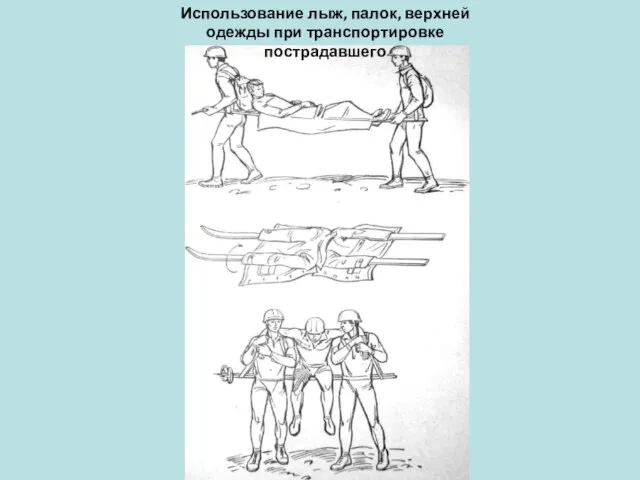 Использование лыж, палок, верхней одежды при транспортировке пострадавшего