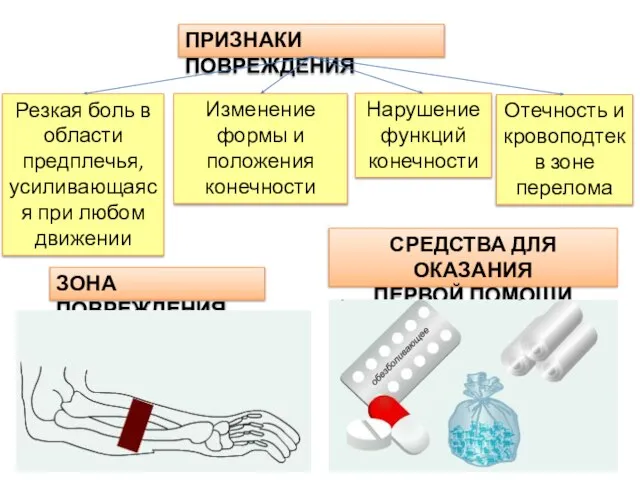 ПРИЗНАКИ ПОВРЕЖДЕНИЯ Резкая боль в области предплечья, усиливающаяся при любом движении ЗОНА