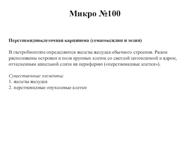 Микро №100 Перстневидноклеточная карцинома (гематоксилин и эозин) В гастробиоптате определяются железы желудка