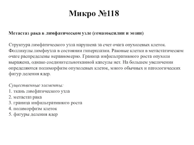 Микро №118 Метастаз рака в лимфатическом узле (гематоксилин и эозин) Структура лимфатического